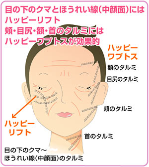 頬・目尻・額・首のタルミにはハッピーワプトスが効果的