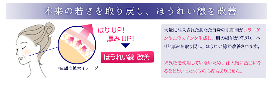 本来の若さを取り戻し、ほうれい線を改善