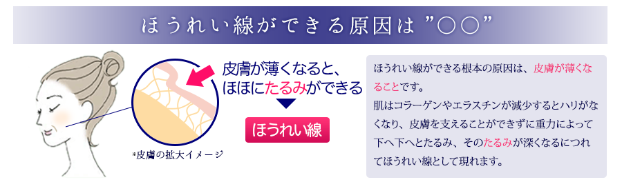 ほうれい線が出来る原因は